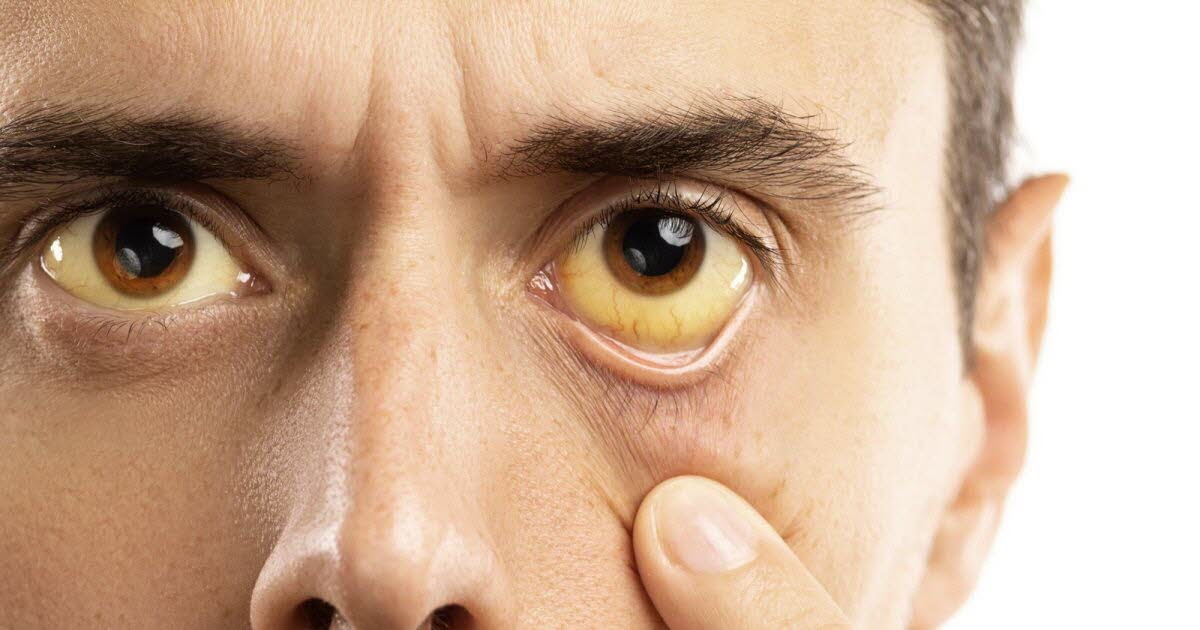 yeux jaune