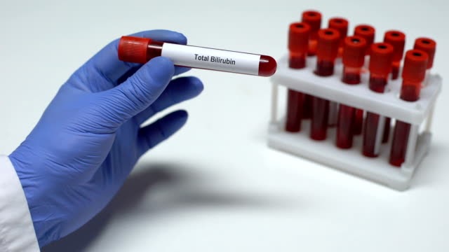 "Heure miroir 20h20"