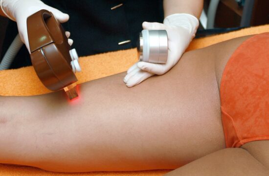 La_révolution_de_l_épilation_laser_à_Caen_:_résultats_bluffants_pour_les_femmes_!
