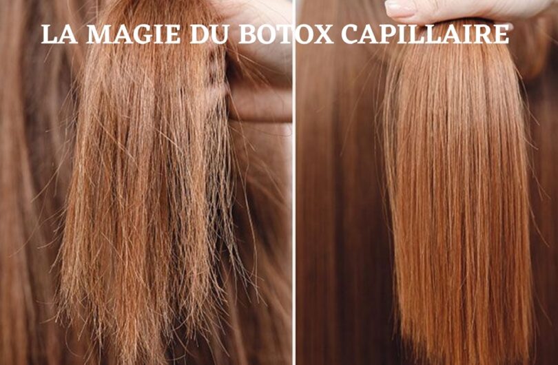 Botox capillaire