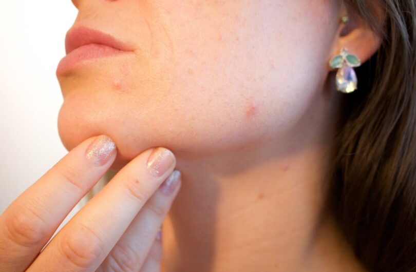 Comment_resserrer_les_pores_:_les_astuces_efficaces
