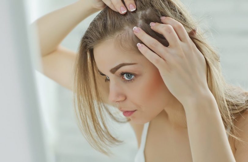 perte-cheveux-femmes-remedes